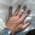 5 mm wide band on man's hand